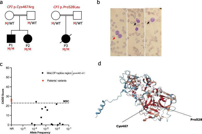 Complete Complement Factor I (CFI) deficiency: a systematic review of forty-nine patients including three novel cases.