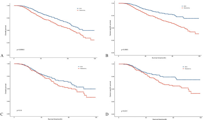 The prognostic differences between breast-conserving surgery and mastectomy in patients with invasive ductal carcinoma who achieved complete response following neoadjuvant chemotherapy: a propensity score matched analysis based on the SEER database.