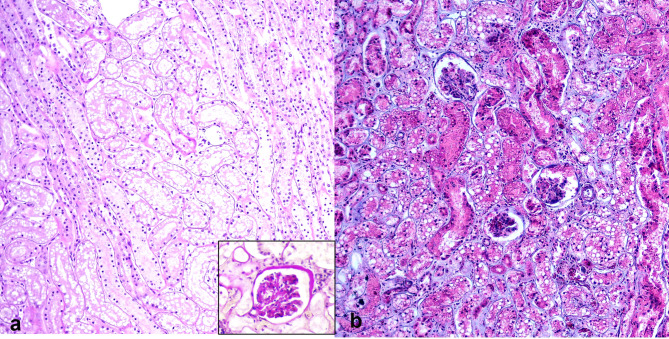 Pathological alteration and caspase-dependent activity of feline kidneys in natural infection of feline morbillivirus.