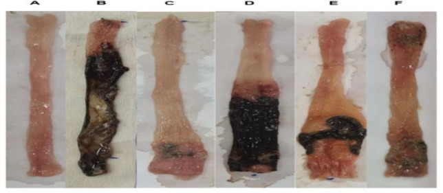 Protective effect of Henna (<i>Lawsonia inermis</i> L.<i>)</i> fixed oil (a Persian medicine preparation) on acetic acid-induced ulcerative colitis in rats.