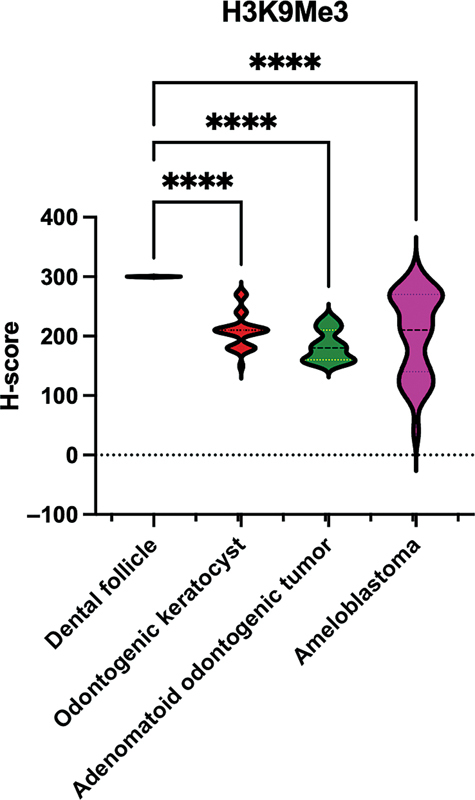 Histone H3K9 Methylation Is Differentially Modified in Odontogenic Cyst and Tumors.