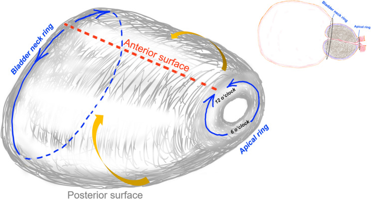"Double rings" En-bloc technique with early anatomical apical release in thuflep for the patients with large glands (≥ 80 mL): the outcomes from single center.