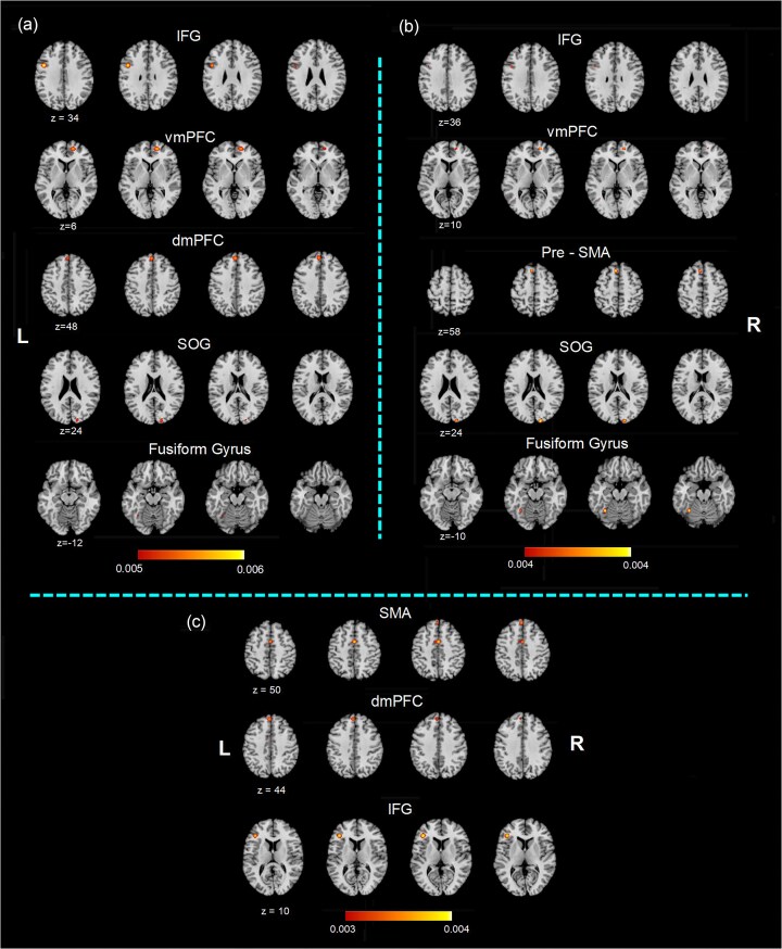 The brain on expert medical performance: a systematic review and activation likelihood estimation functional magentic resonance imaging meta-analysis.