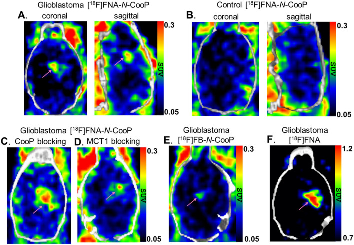 Rapid cleavage of 6-[18F]fluoronicotinic acid prosthetic group governs BT12 glioblastoma xenograft uptake: implications for radiolabeling design of biomolecules