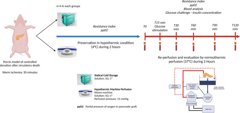 Is 2 h of Hypothermic Machine Perfusion for Pancreas Preservation Effective in Improving Graft Reperfusion?