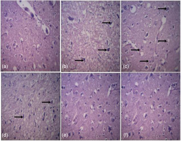 Therapeutic Effects of Naringin on Bisphenol A-Induced Oxidative Stress Damage in Nervous and Reproductive Systems of Cockerel Chickens.