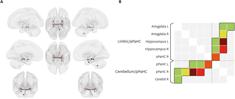 The Effectiveness of VR-Based Cognitive Training Program for Mild Cognitive Impairment: A Pilot Study.