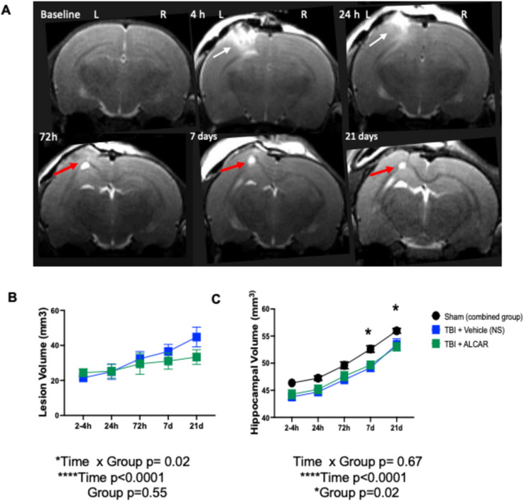 Longitudinal Brain Structural, Neurochemical, and Behavioral Changes Following Traumatic Brain Injury in Immature Rat Brain with ALCAR Treatment