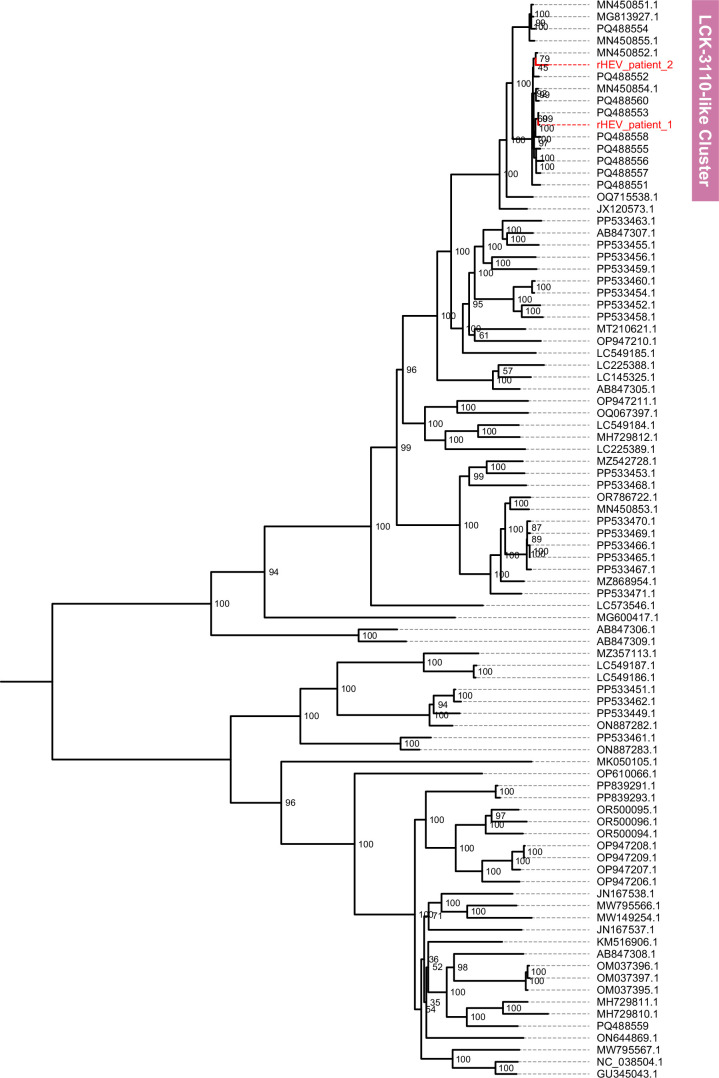 The high burden of HEV infection in solid organ transplant recipients.
