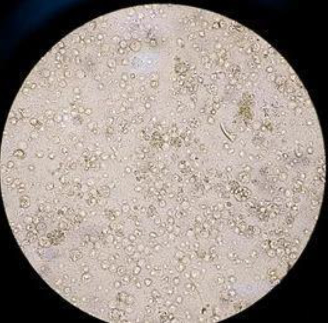 Fosfomycin resistance in extended-spectrum beta-lactamase producing <i>Escherichia coli</i> isolated from urinary tract-infected patients in a tertiary care hospital.