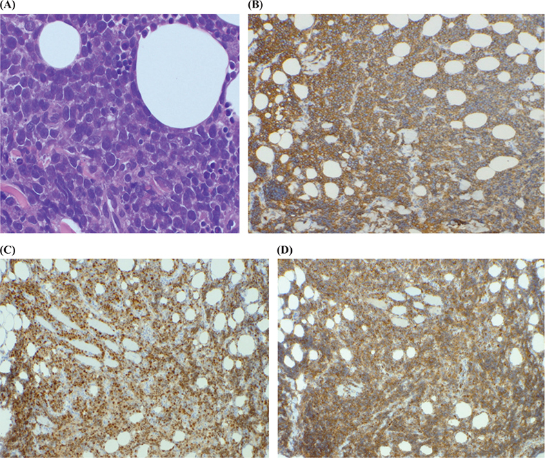 Skin Erosion on the Nasal Root with Marked Right Eyelid Swelling: A Quiz.