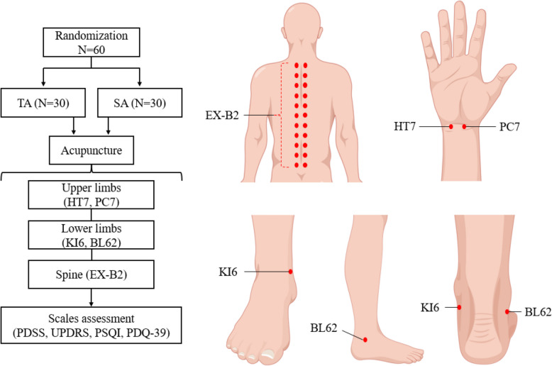 Acupuncture versus sham acupuncture in the treatment of insomnia for patients with Parkinson's disease: a randomized controlled clinical trial.