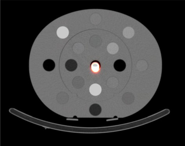 Dosimetric study on radioembolization with 166Ho poly L-lactic acid microspheres: dead time effects on prediction power.