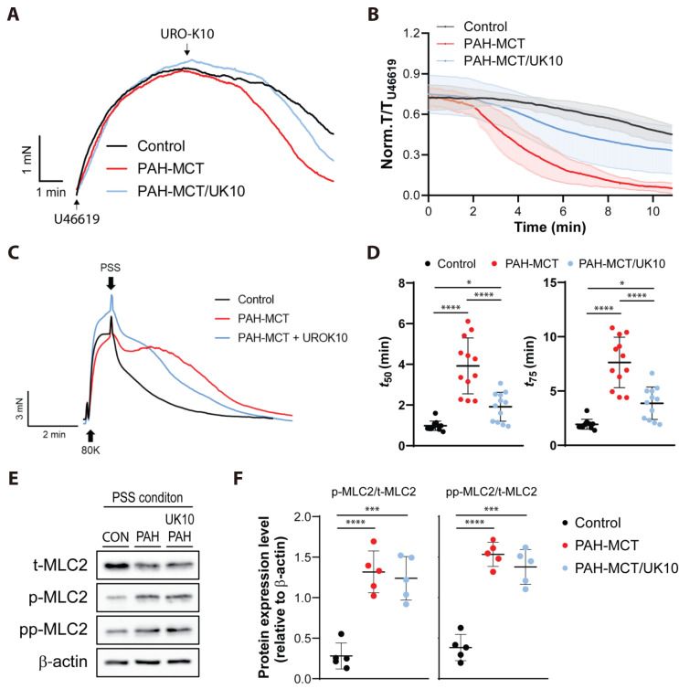 Effects of <i>in vivo</i> treatment with K<sub>v</sub>7.4 activator, URO-K10, on the impaired relaxation of pulmonary arteries in the monocrotaline-induced pulmonary hypertensive rats.