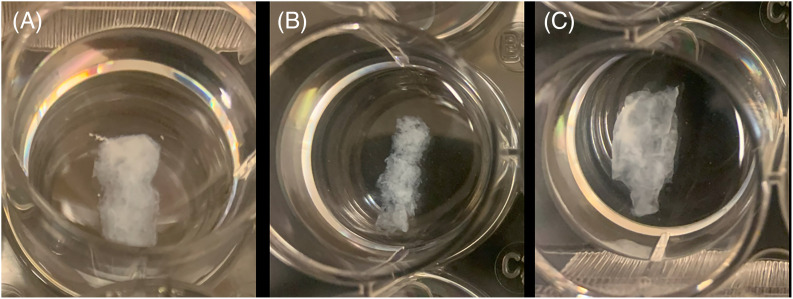 Early fiber development in human vocal folds: An in vitro pilot study.