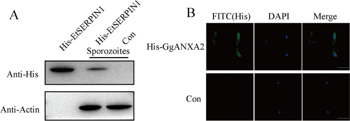 EtSERPIN1 binding with chicken ANXA2 is essential for Eimeria tenella attachment and invasion process.