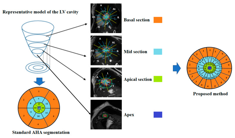 Deep Learning-Based Algorithm for the Classification of Left Ventricle Segments by Hypertrophy Severity.