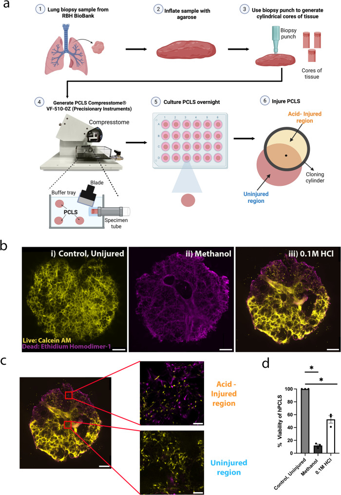 A human PCLS model of lung injury and repair for discovery and pharmaceutical research.