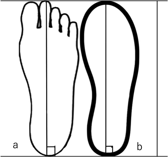 Associations between footwear fit and developmental milestones in toddlers: a cross-sectional study.