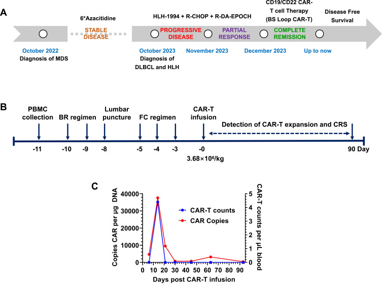 Novel Loop-Structure-Based CD19/CD22 Dual-Target CAR-T Therapy for High-Risk Diffuse Large B-Cell Lymphoma Presenting with Hemophagocytic Lymphohistiocytosis: A Case Report.