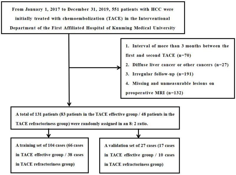 Development and Validation of a Radiomics Nomogram Based on Magnetic Resonance Imaging and Clinicoradiological Factors to Predict HCC TACE Refractoriness.