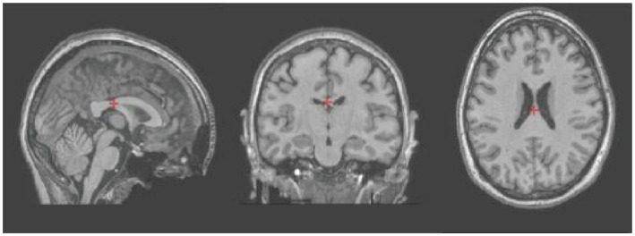 Breaking barriers: broadening neuroscience education via cloud platforms and course-based undergraduate research.