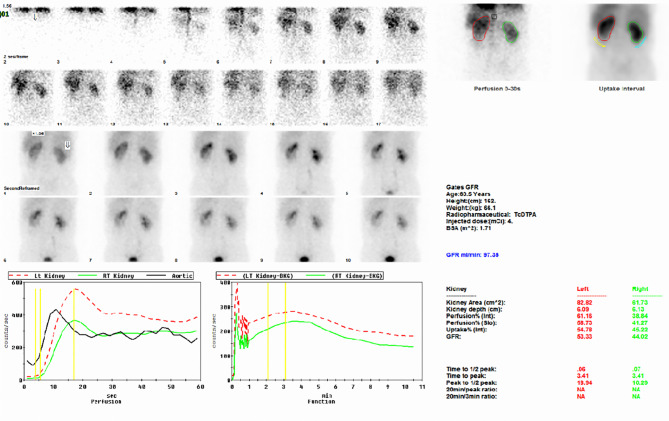 Primary renal mucosa-associated lymphoid tissue lymphoma coexisting with immune thrombocytopenia.