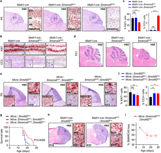 SMARCA5 is required for the development of granule cell neuron precursors and Sonic Hedgehog Medulloblastoma growth.