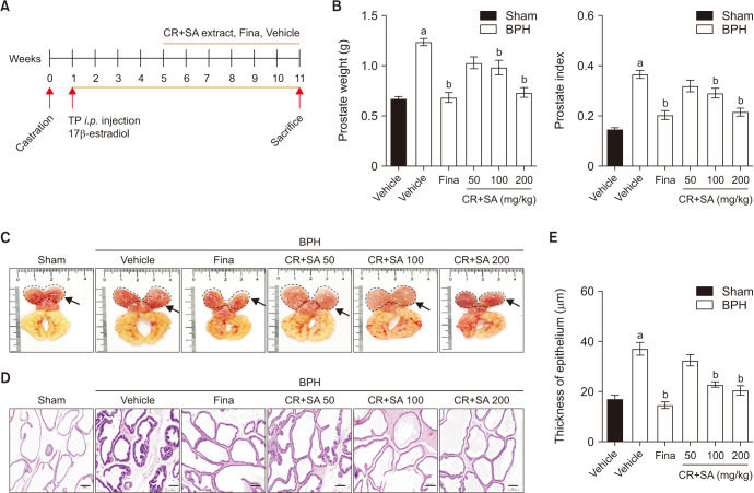 The Combination of <i>Curcumae Radix</i> and Syzygium Aromaticum Extracts Mitigates Benign Prostatic Hyperplasia through Anti-Proliferative and Anti-Inflammatory Effects.
