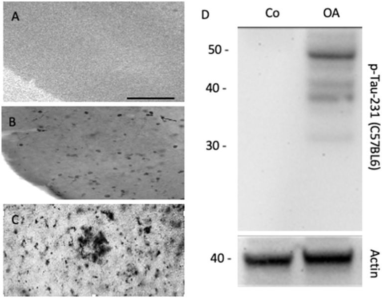 Three-dimensional organotypic mouse brain slices to study Alzheimer's disease pathologies: a review.