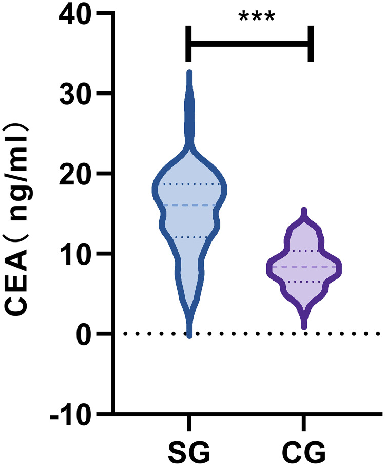 Clinical Value of Low-Dose Spiral CT Combined with Serum CEA in the Differential Diagnosis of Early Lung Cancer.