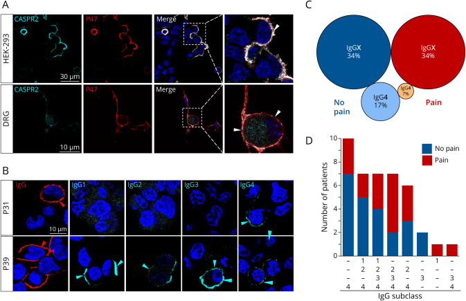Neuropathic Pain and Distinct CASPR2 Autoantibody IgG Subclasses Drive Neuronal Hyperexcitability.