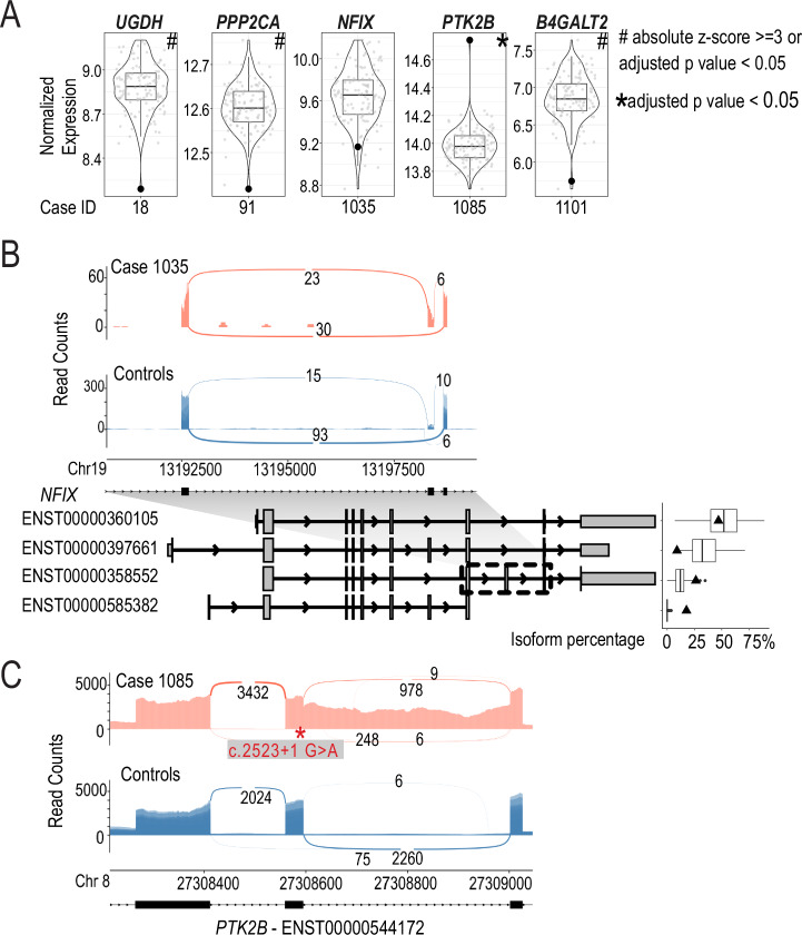 Assessing the diagnostic impact of blood transcriptome profiling in a pediatric cohort previously assessed by genome sequencing.