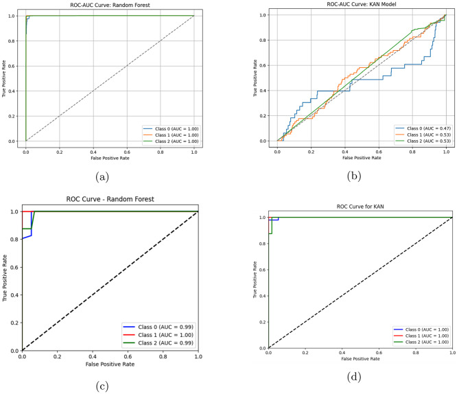 Thyroid disease classification using generative adversarial networks and Kolmogorov-Arnold network for three-class classification.