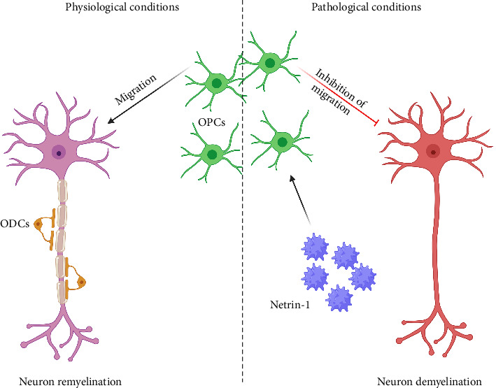Netrin-1: Dual Roles in Neuroinflammation and Neurodegenerative Disease Dynamics.