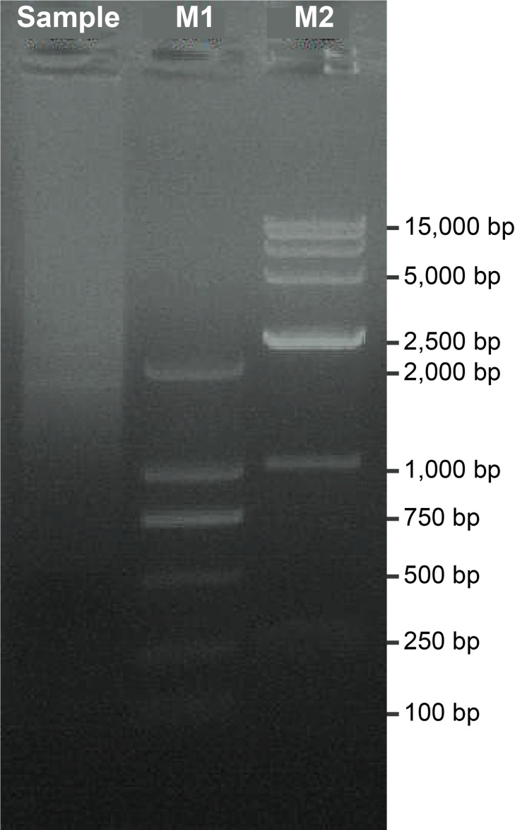 RACE-Nano-Seq: Profiling Transcriptome Diversity of a Genomic Locus.