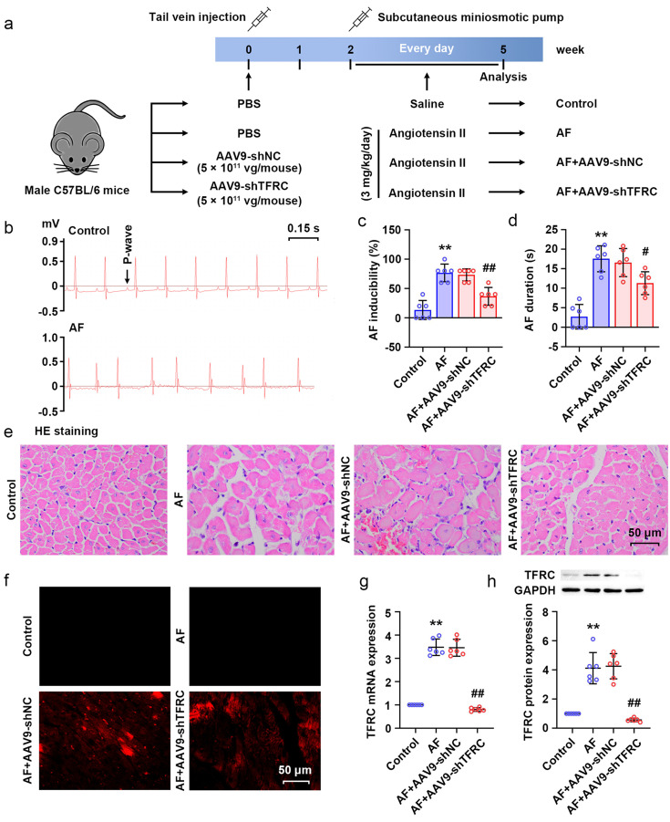 Transferrin receptor knockdown attenuates atrial fibrillation by inhibiting cardiomyocyte ferroptosis and atrial fibrosis.