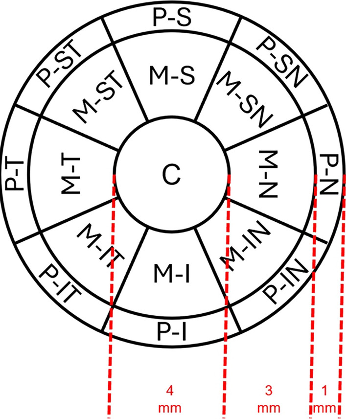 Wide-angle fluid reservoir thickness changes during short-term scleral lens wear.