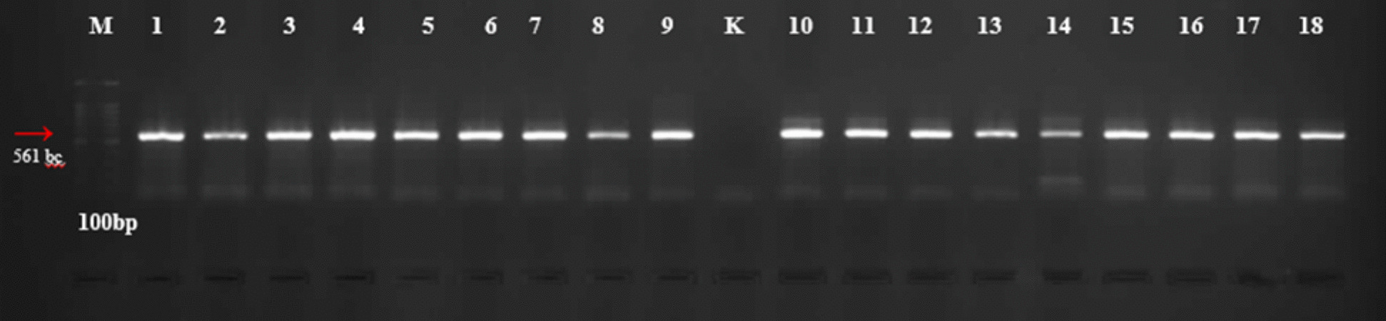 Bloodthirsty bites: host-feeding patterns of phlebotomine sand flies from two localities in the Aegean Region of Türkiye.