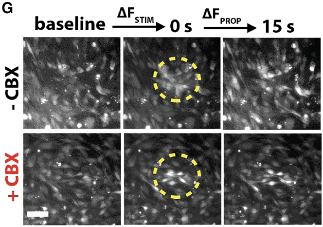 Neuroinflammation and EIF2 Signaling Persist despite Antiretroviral Treatment in an hiPSC Tri-culture Model of HIV Infection.