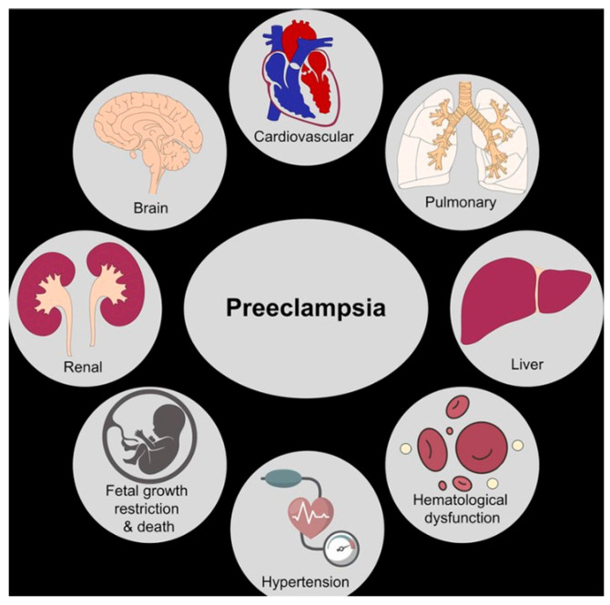 Preeclampsia as a Risk Factor of Postmenopausal Cardiovascular Disease: A Cross-Sectional Study.