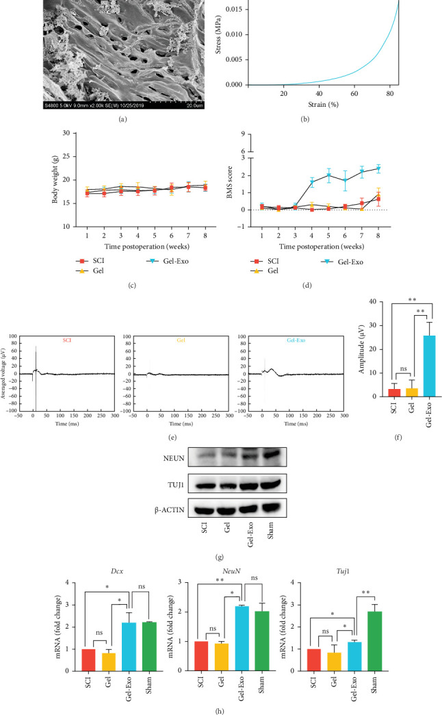 Exosome-Loaded Bioscaffolds for Spinal Cord Injuries: A Review.