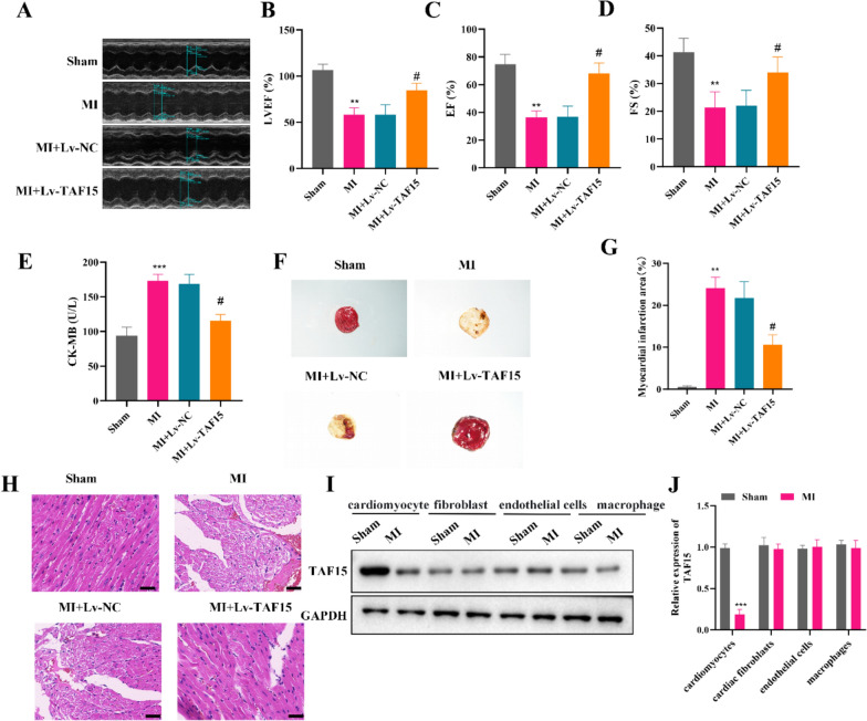 Targeting PRMT1-mediated methylation of TAF15 to protect against myocardial infarction by inhibiting ferroptosis via the GPX4/NRF2 pathway.