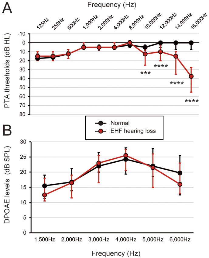 Music Listening Habits and Auditory Functions in Medical College Students.