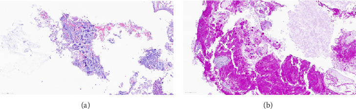 A Medical Rarity: Isolated <i>Toxoplasma gondii</i> Abscess in the Pituitary Gland of an Immunocompetent Patient.
