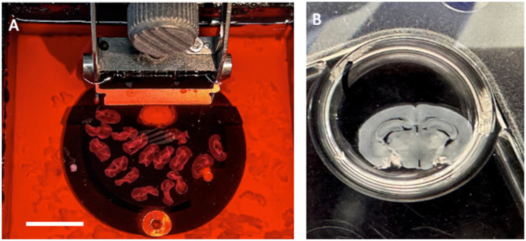 Three-dimensional organotypic mouse brain slices to study Alzheimer's disease pathologies: a review.