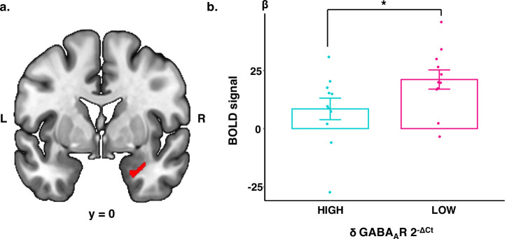 Transcription of GABA<sub>A</sub> receptor subunits in circulating monocytes and association to emotional brain function in premenstrual dysphoric disorder.
