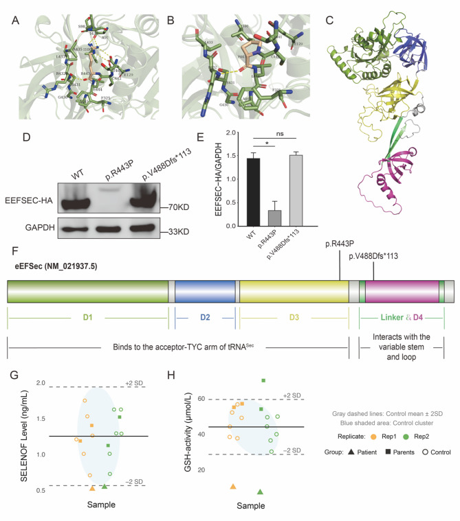 Identifying compound heterozygous variants in the EEFSEC gene linked to progressive cerebellar atrophy.