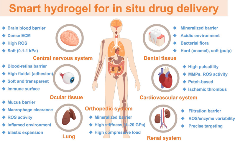 Smart hydrogels for in situ tissue drug delivery.