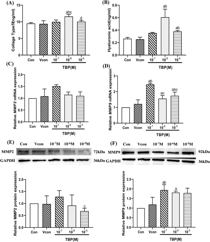 Tributyl phosphate as a type of environmental endocrine disruptor associated with liver fibrosis: insights from NHANES and <i>in vitro</i> validation.